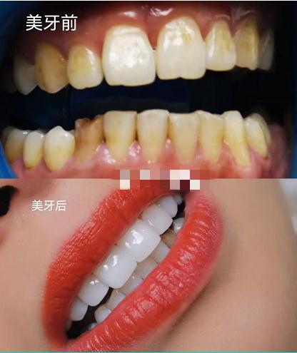 貴陽(yáng)美牙培訓(xùn)學(xué)校(專(zhuān)業(yè)美牙培訓(xùn)學(xué)校)
